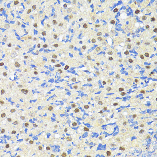 TRIM27 Polyclonal Antibody