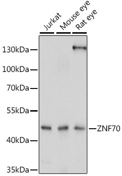 ZNF70 Polyclonal Antibody