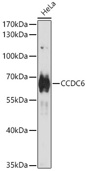 CCDC6 Polyclonal Antibody
