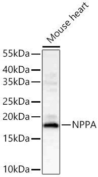 NPPA Polyclonal Antibody