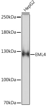 EML4 Polyclonal Antibody