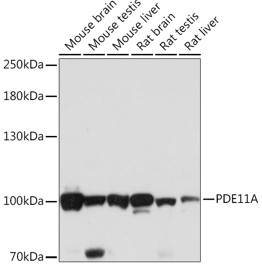 PDE11A Polyclonal Antibody