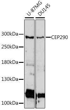 CEP290 Polyclonal Antibody