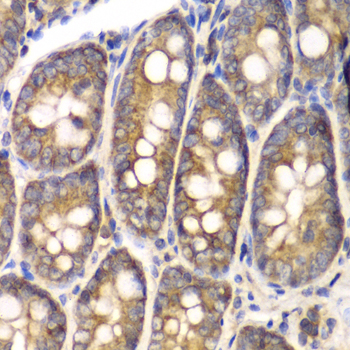 SPARC Polyclonal Antibody