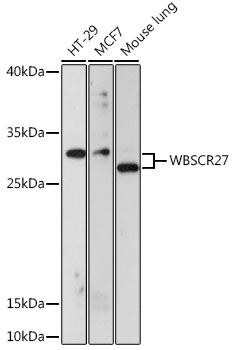 WBSCR27 Polyclonal Antibody