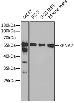 KPNA2 Polyclonal Antibody