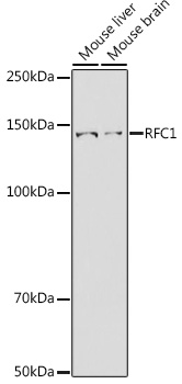 RFC1 Polyclonal Antibody