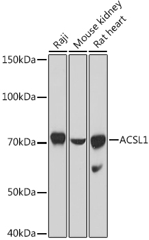 ACSL1 Polyclonal Antibody&nbsp;<img src="images/icon_newarrival.gif" alt="new" border="0">