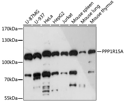 PPP1R15A Polyclonal Antibody