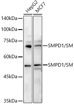 SMPD1 / ASM Polyclonal Antibody