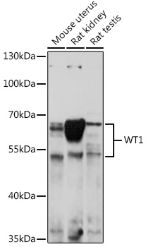 WT1 Polyclonal Antibody