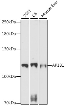 AP1B1 Polyclonal Antibody