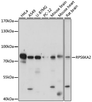 RPS6KA2 Polyclonal Antibody