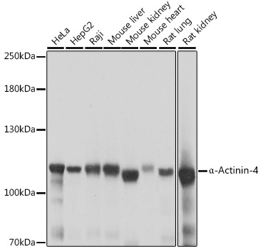 a-Actinin-4 Polyclonal Antibody