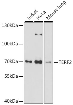 TERF2 Polyclonal Antibody