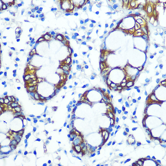 FUT4 Polyclonal Antibody