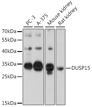 DUSP15 Polyclonal Antibody