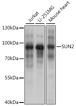 SUN2 Polyclonal Antibody