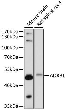 ADRB1 Polyclonal Antibody&nbsp;<img src="images/icon_newarrival.gif" alt="new" border="0">