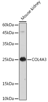 COL4A3 Polyclonal Antibody
