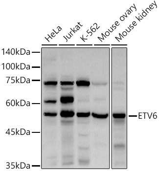 ETV6 Polyclonal Antibody