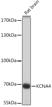 KCNA4 Polyclonal Antibody