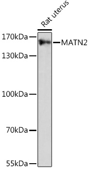 MATN2 Polyclonal Antibody