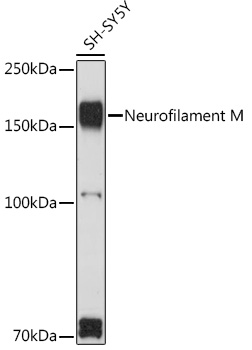 Neurofilament M Polyclonal Antibody