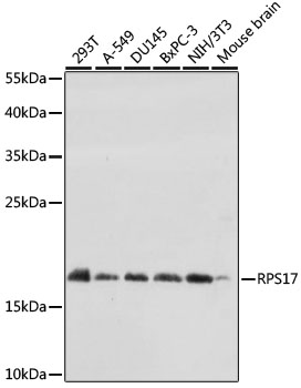 RPS17 Polyclonal Antibody