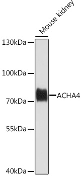 ACHA4 Polyclonal Antibody&nbsp;<img src="images/icon_newarrival.gif" alt="new" border="0">