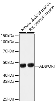 ADIPOR1 Polyclonal Antibody&nbsp;<img src="images/icon_newarrival.gif" alt="new" border="0">