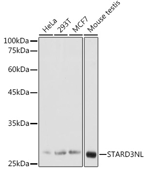 STARD3NL Polyclonal Antibody