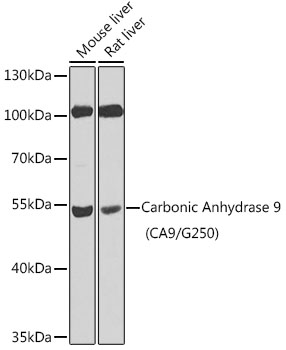 Carbonic Anhydrase 9 (CA9/G250) Polyclonal Antibody