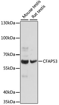 CFAP53 Polyclonal Antibody