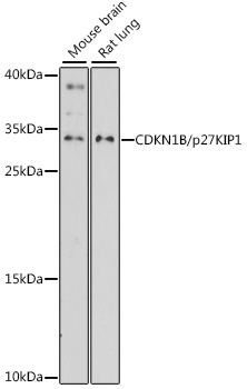 CDKN1B/p27KIP1 Polyclonal Antibody