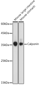 Calponin Polyclonal Antibody