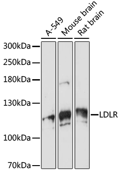 VPS18 Polyclonal Antibody
