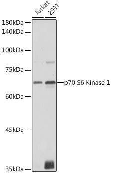 p70 S6 Kinase 1 Polyclonal Antibody