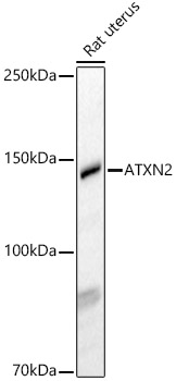 ATXN2 Polyclonal Antibody