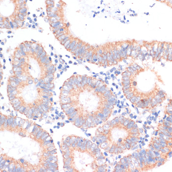 eIF4EBP1 Polyclonal Antibody