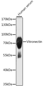 Vitronectin Polyclonal Antibody