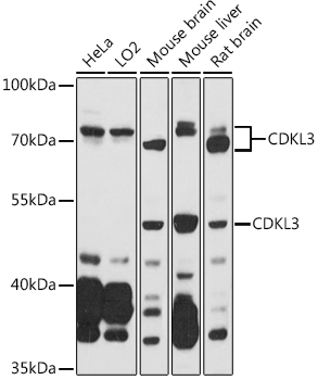 CDKL3 Polyclonal Antibody