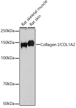 Collagen I/COL1A2 Polyclonal Antibody