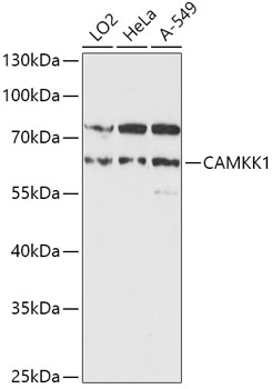 CAMKK1 Polyclonal Antibody