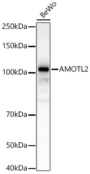 AMOTL2 Polyclonal Antibody