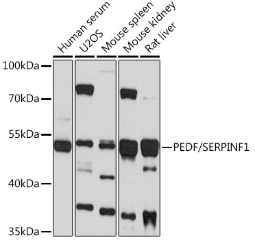 PEDF/SERPINF1 Polyclonal Antibody