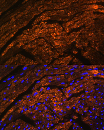 TTN Polyclonal Antibody