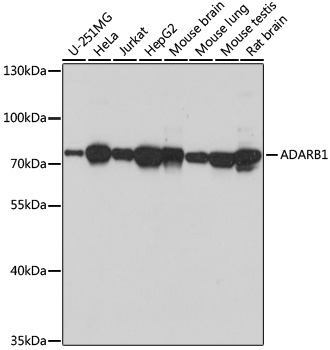 ADARB1 Polyclonal Antibody&nbsp;<img src="images/icon_newarrival.gif" alt="new" border="0">