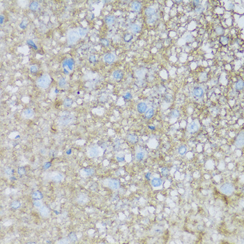 ATP1B2 Polyclonal Antibody