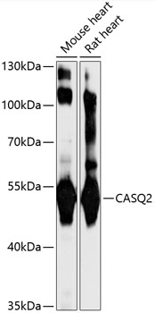 CASQ2 Polyclonal Antibody